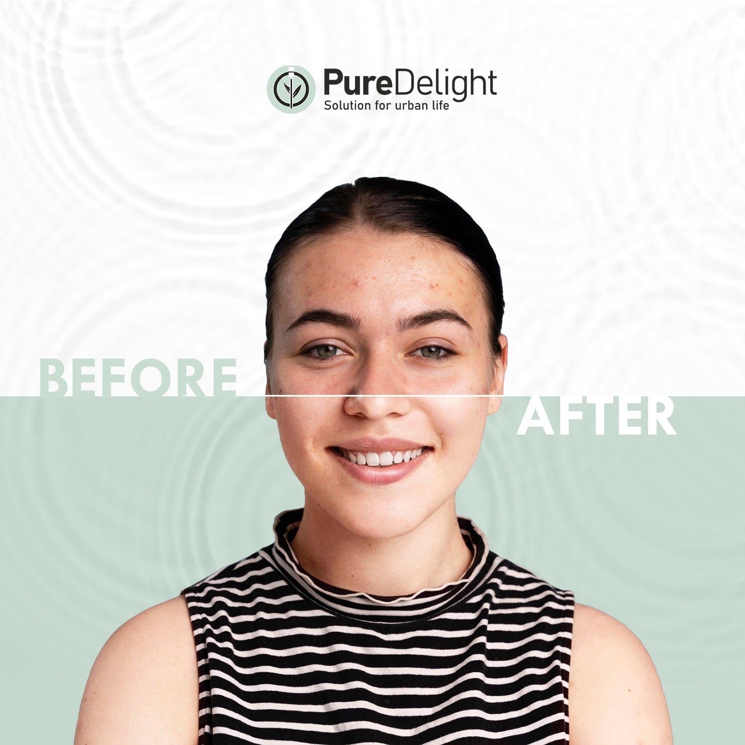 PureDelight Anti-Acne Foaming Face Wash